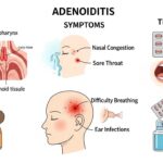 Adenoidid: Causes, Symptoms, and Treatments